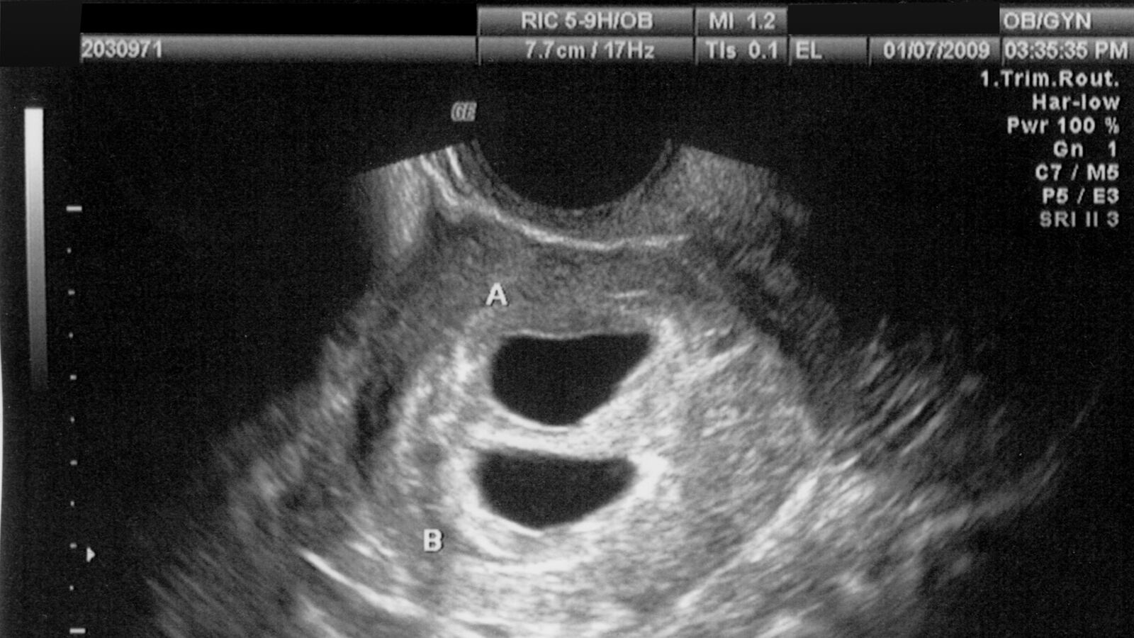 cheats/2014/01/18/n-c-abortion-ultrasound-law-illegal/140118-ultrasound-cheat_jgjvmc