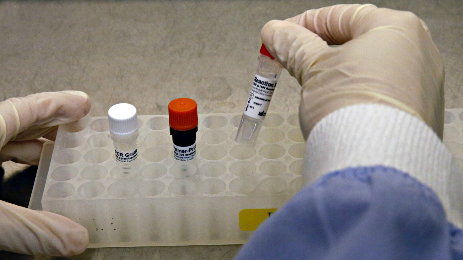 cheats/2016/09/27/whistleblower-cdc-is-using-the-wrong-zika-test/160927-cdc-whistleblower-zika-test-cheat_xs8z8e