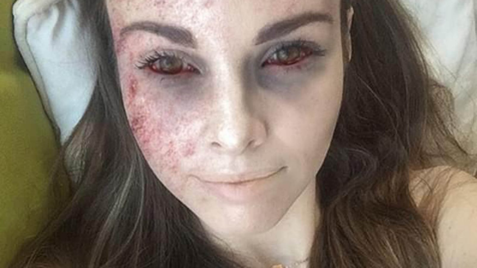 181209-ebola-selfie-cheat_wbfu3f