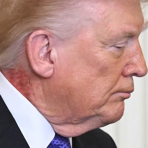 US President Donald Trump looks on during a Medal of Honor ceremony in the East Room of the White House on March 2, 2026, in Washington, DC. President Trump awarded the Medal of Honor to retired Army Command Sgt. Major Terry P. Richardson, who served in the Vietnam War, posthumously to Army Master Sgt. Roderick W. Edmonds, who served in World War II, and posthumously to Staff Sgt. Michael Ollis, who died in combat in Afghanistan in 2013. (Photo by SAUL LOEB / AFP via Getty Images)