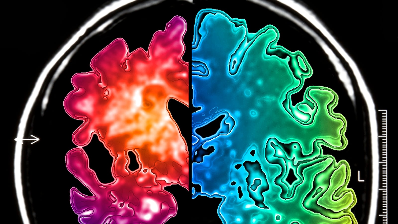 articles/2014/04/04/twenty-years-of-alzheimer-s-research-may-have-focused-on-the-wrong-protein/140403-lopatto-alzheimers_z0c3fa