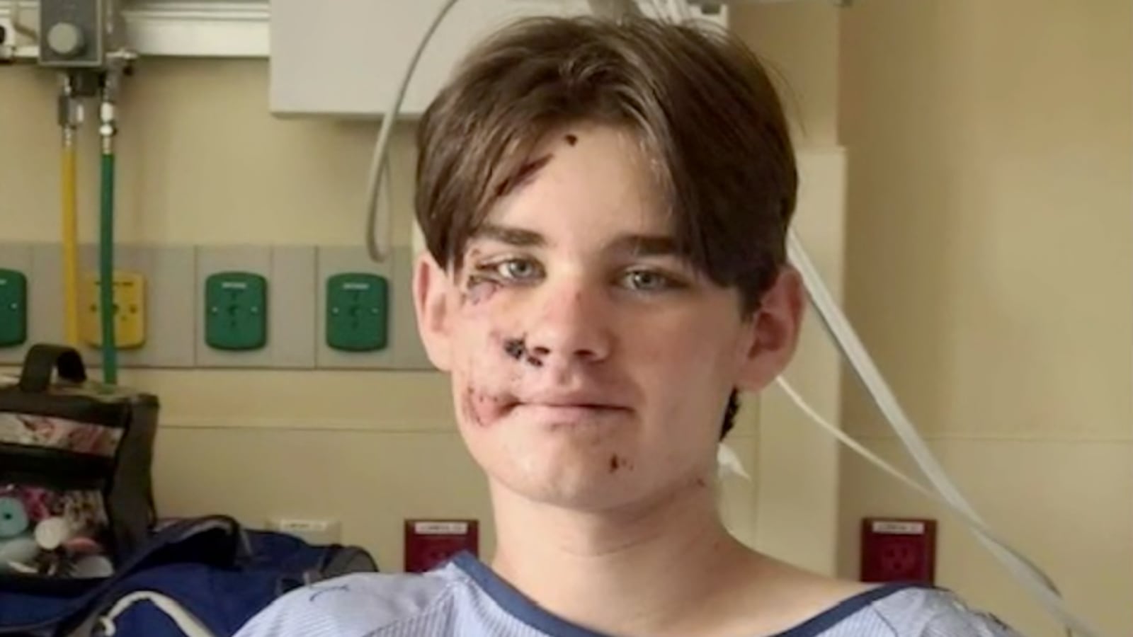Wyatt Kauffman, 14, survived falling almost 100 feet off a cliff at the Grand Canyon in Arizona.