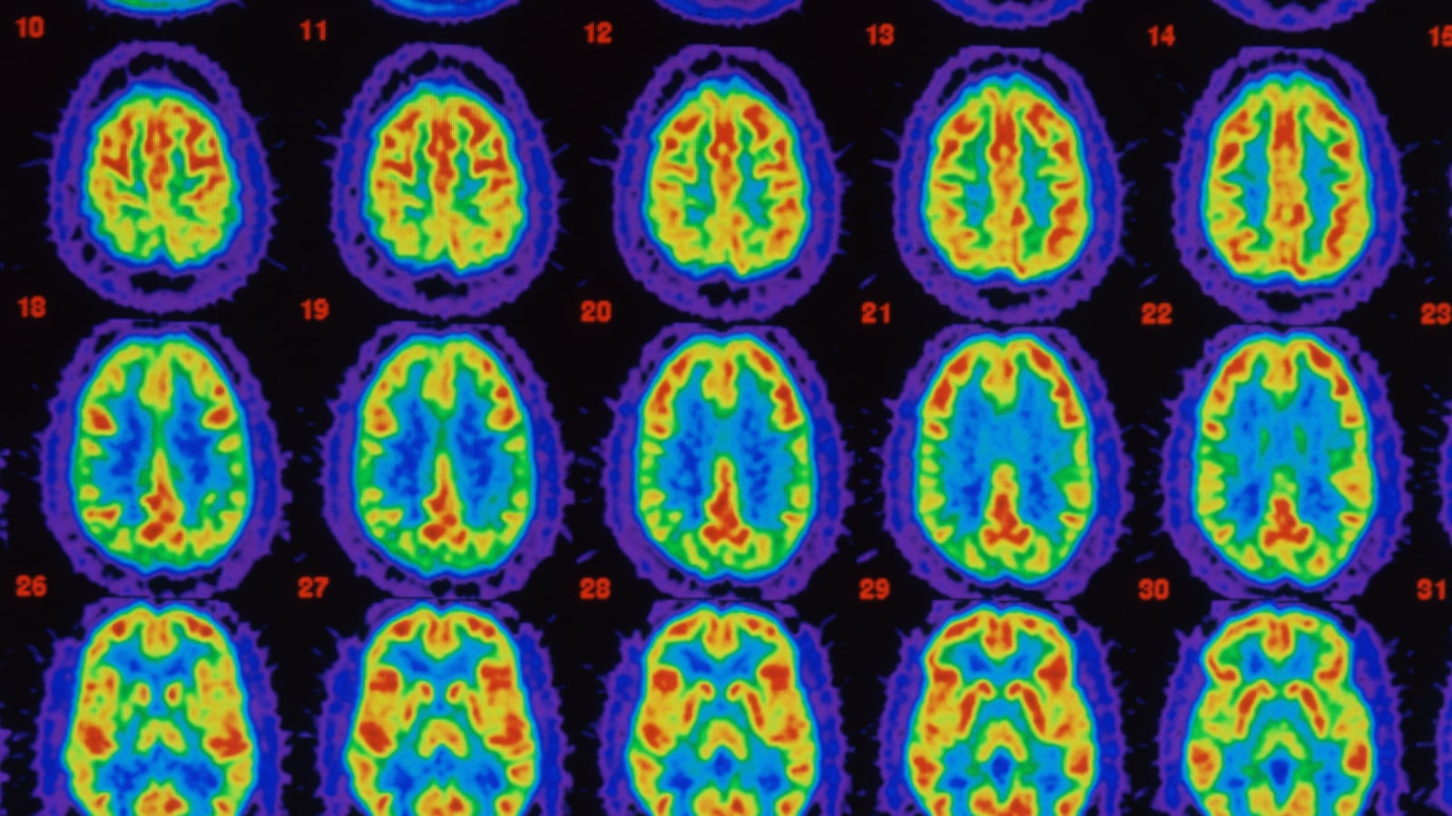 articles/2014/05/24/trial-drug-reverses-alzheimer-s-disease-in-mice/140523_Lopatto_alzheimers_mice_w7cztn