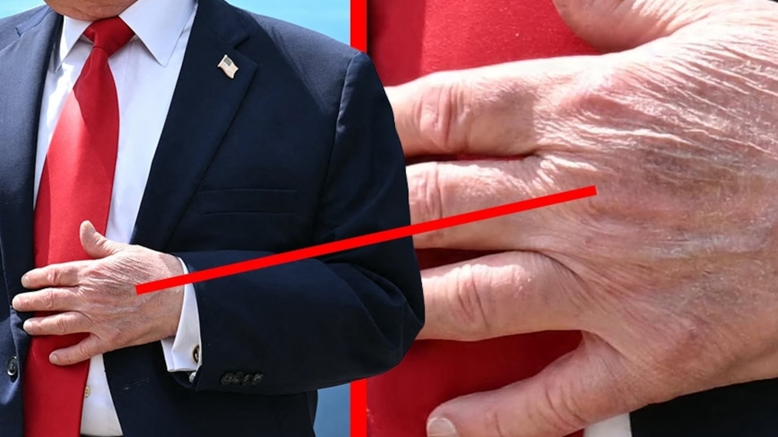 Donald Trump's hands on June 5, 2026.