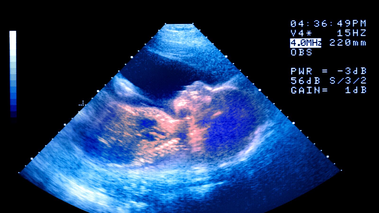 cheats/2014/02/17/record-boom-in-ivf-babies/130829-in-vitro-tease_a5ewt0