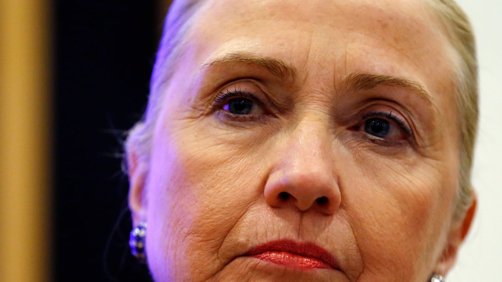 cheats/2012/12/31/hillary-clinton-blood-clot-in-brain/hillary-clinton-blood-clot-tease1_vb5ogl