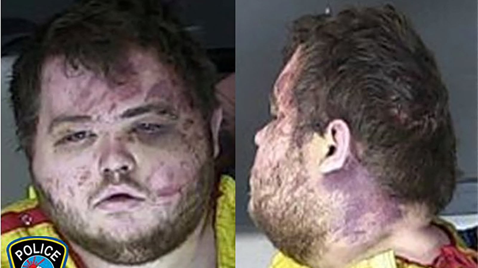 2022-11-23T220239Z_1373539595_RC2SRX99YLCL_RTRMADP_3_COLORADO-SHOOTING_yizy0q