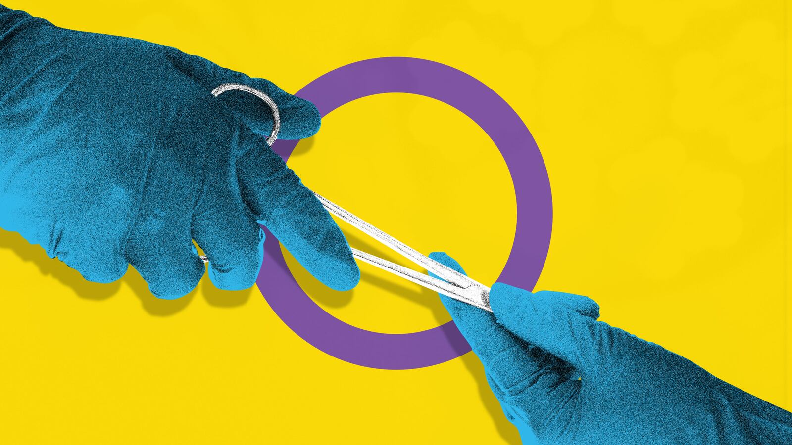 190210-allen-intersex-surgeries-hero_xtwlb6