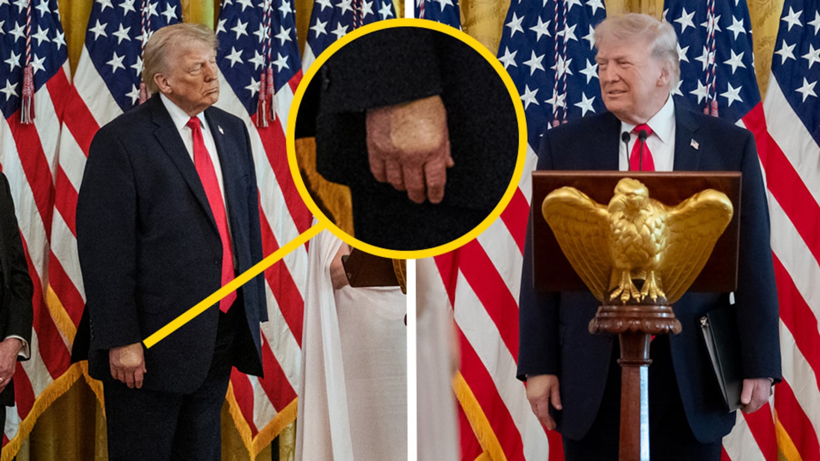 Makeup shown on Donald Trump's hand.