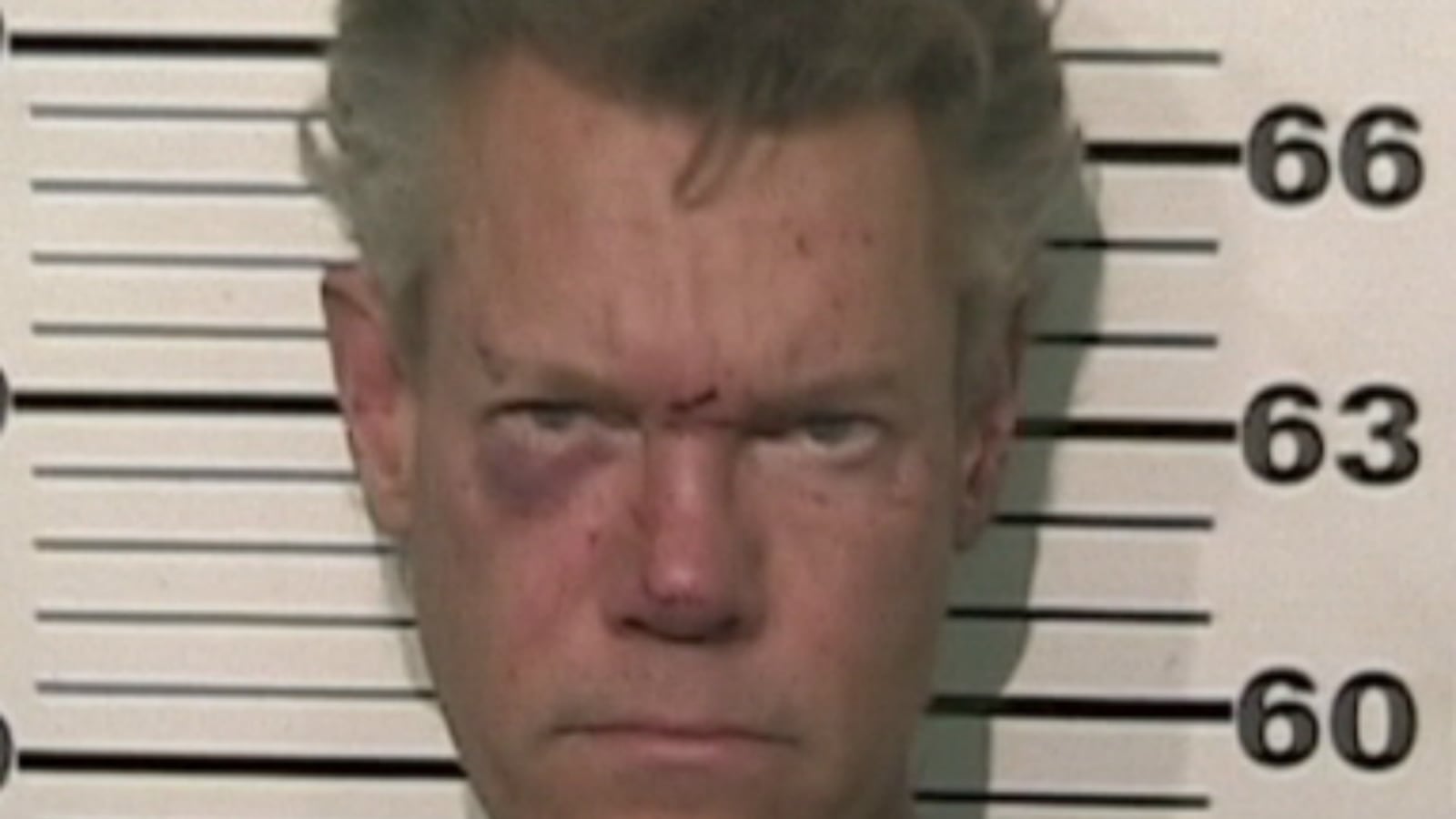 cheats/2012/08/08/naked-randy-travis-gets-dwi-charge/randy-travis-naked-cheat_wcmbyq