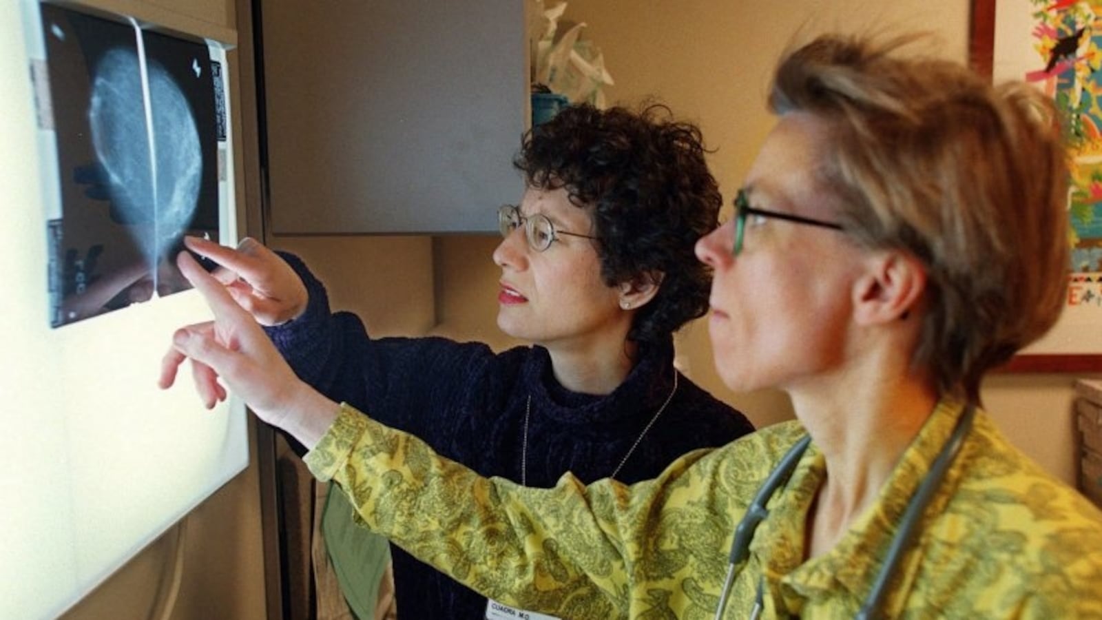 cottle-masectomy_zkmljo