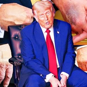 A photo collage of Donald Trump's bruised hands throughout the year.