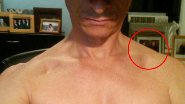 articles/2011/06/08/weinergate-latest-clintons-unhappy-about-anthony-weiner-sexting/anthony-weiner-photos-gallery-2_jlrotu