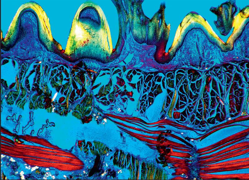 galleries/2015/02/02/a-way-too-close-look-at-the-human-body/150130-science-beautiful-tongue-tissue_jnlwrh