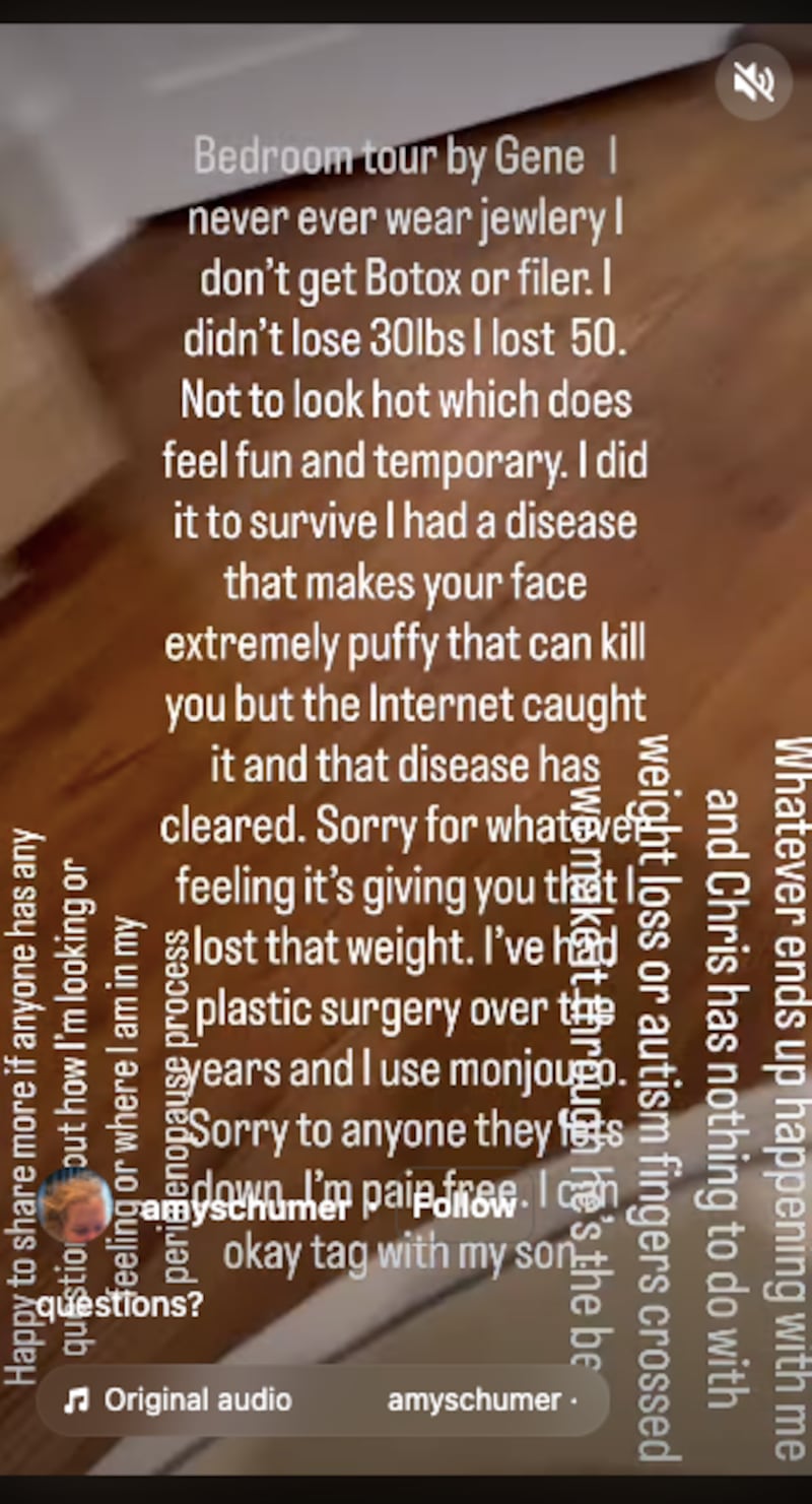 Amy Schumer/Instagram