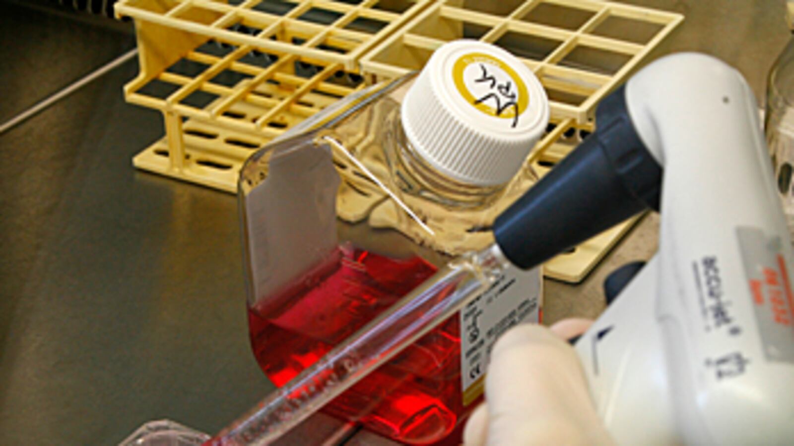 cheats/2010/10/11/first-human-treated-with-stem-cells/stem-cells_rjfbmt