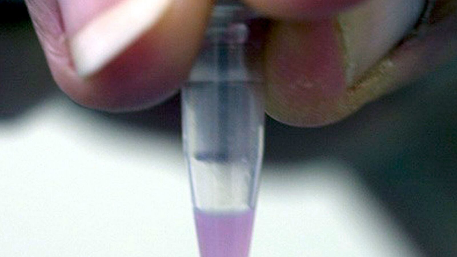 cheats/2014/10/21/cell-transplant-helps-paralyzed-man-walk/141021-celltransplant-cheat_krk3xb