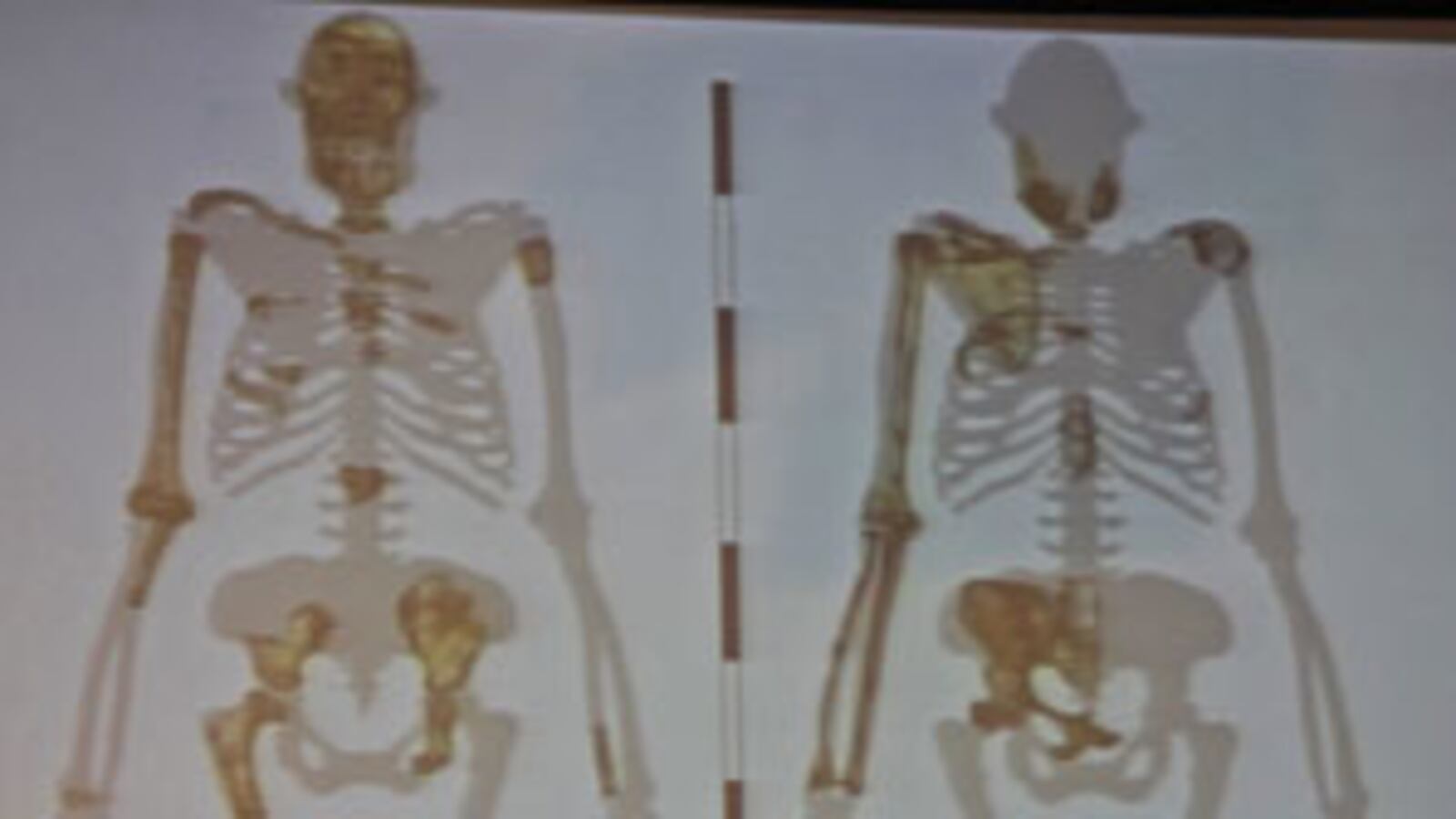 cheats/2010/04/08/new-hominid-species-found-in-s-africa/hominid_xzijkg