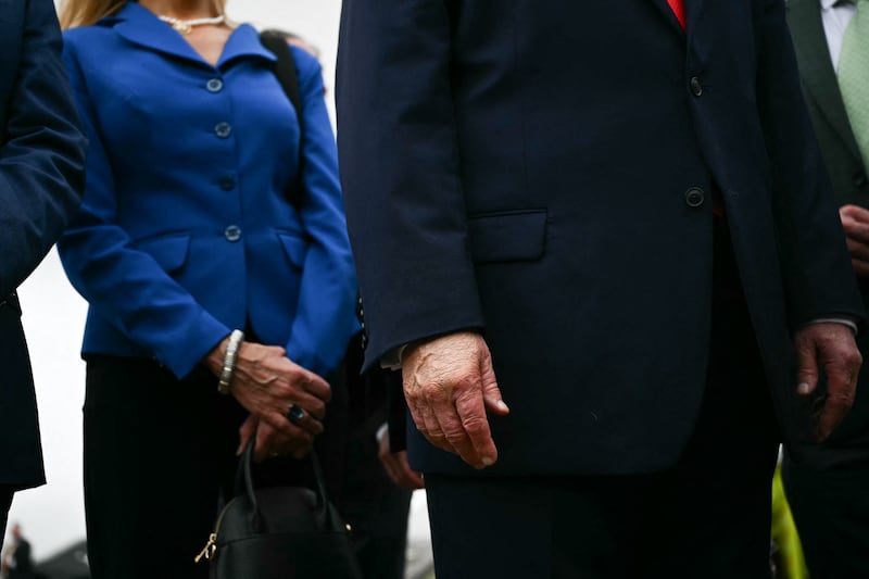 Trump applies makeup to conceal bruising, which the White House claims is from handshaking and his Aspirin use.