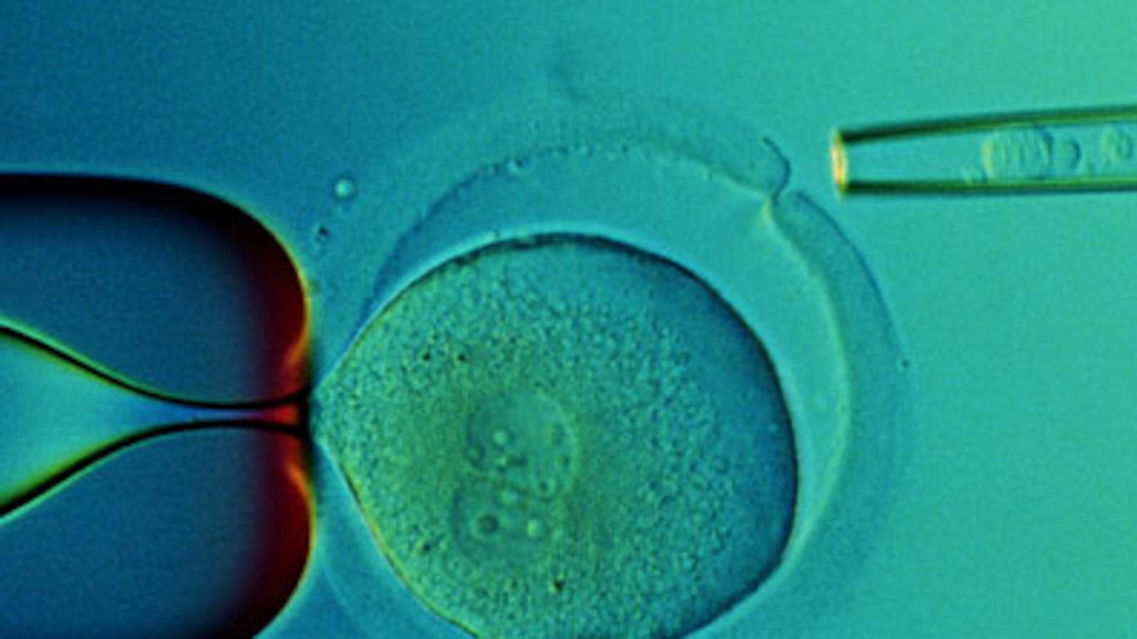 cheats/2009/03/06/obama-to-overturn-stem-cell-ban/stem-cell_jwazns