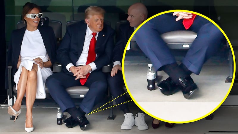 Close-up of Donald Trump's swollen legs.