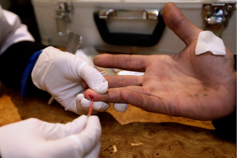 articles/2013/08/14/the-porn-industry-s-hepatitis-problem/130813-snow-hep-tease_qhpi4t