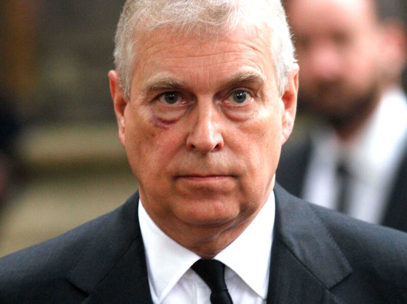 Prince Andrew, Duke of York, with a black eye in 2017. Prince Harry has denied getting into a physical fight with his uncle.
