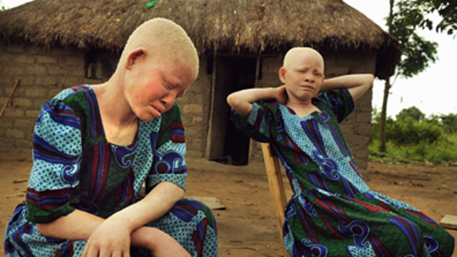 articles/2009/10/28/in-tanzania-superstitions-spur-violence-against-albinos/kouri-albinos_59028_azbjui
