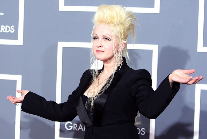 galleries/2012/08/02/pamela-anderson-jeff-holm-more-celebs-who-wear-there-s-something-about-mary-hair-photos/mary-hair-8_ddnmta