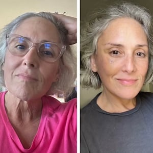 Ricki Lake reveals her before and after facelift photos