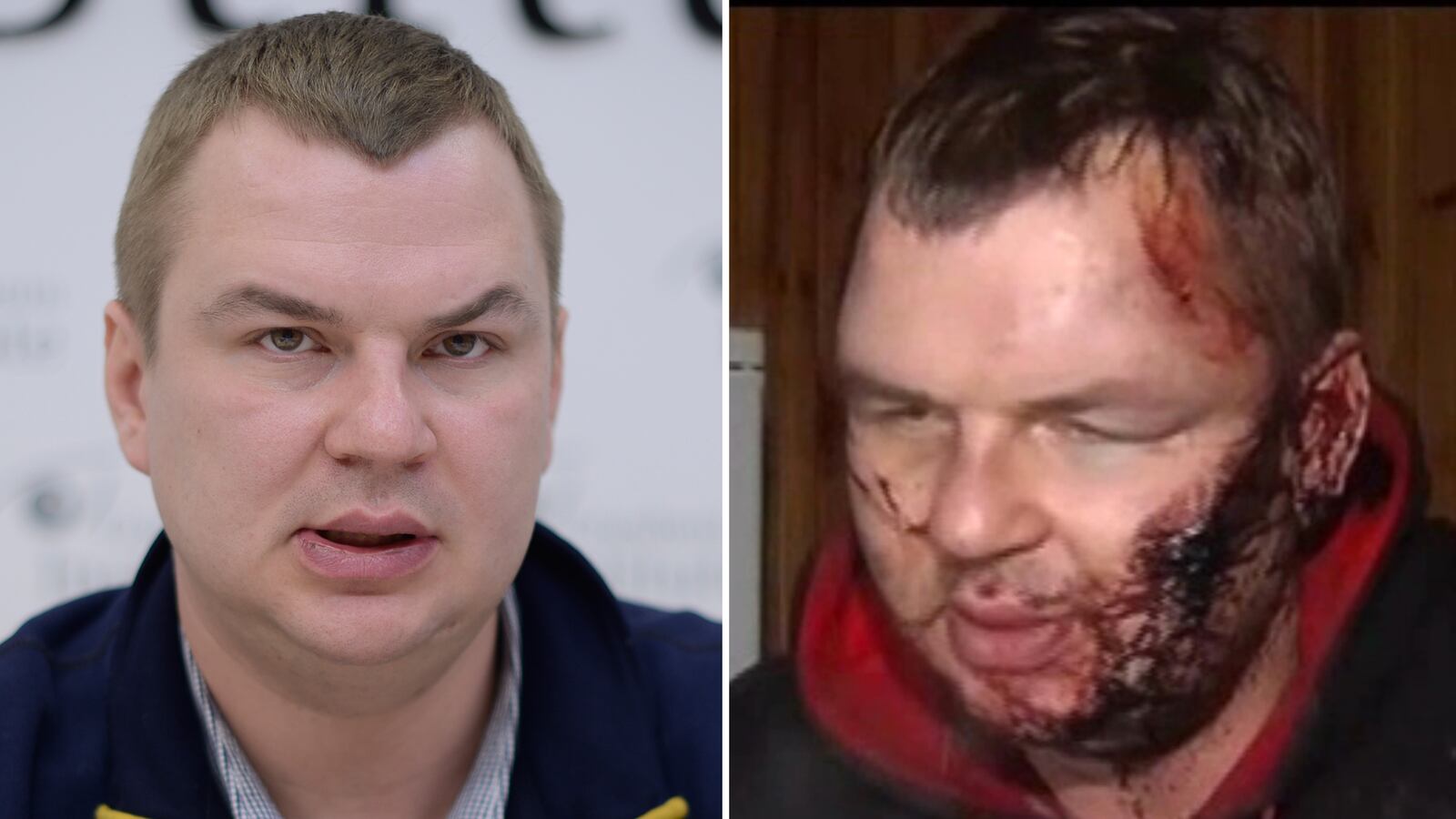 articles/2014/02/01/was-a-ukraine-activist-tortured-by-a-government-death-squad/140131-oleg-crucifixion-tease_lqni0c