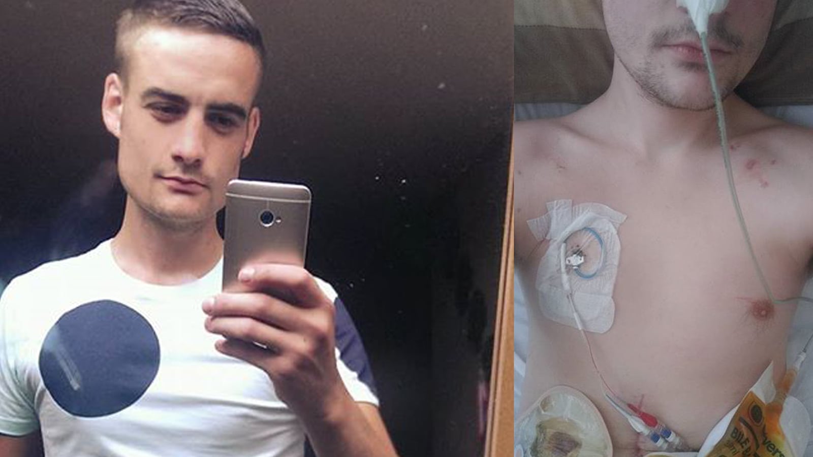 articles/2015/11/06/what-it-s-like-to-live-with-an-invisible-illness/151105-lytton-crohns-disease-tease_hxlkpb