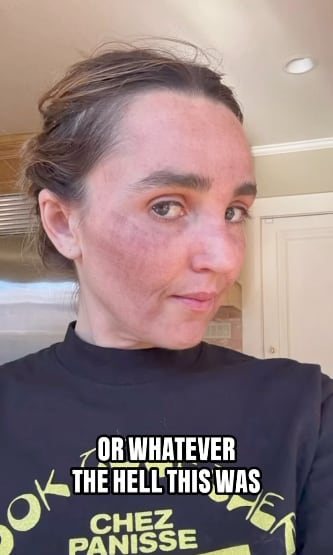 Chloe Fineman shared photos from her "Botched" album on Instagram.