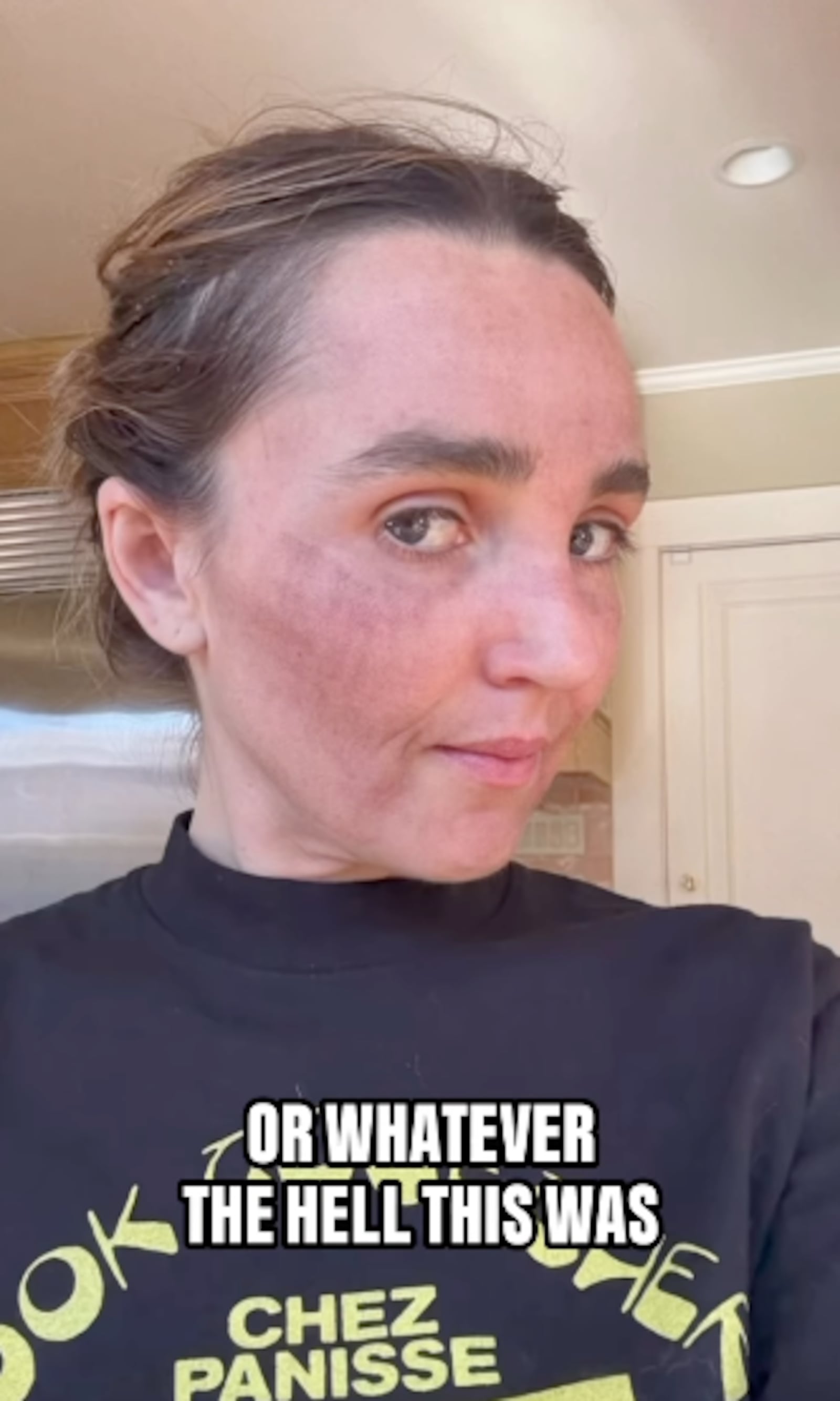 Chloe Fineman shared photos from her "Botched" album on Instagram.