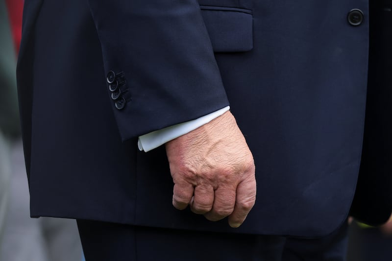 U.S. President Donald Trump's hand as he attends the Amgen Irish Open at Trump International Golf Links in Doonbeg, Ireland, September 13, 2026. REUTERS/Kylie Cooper