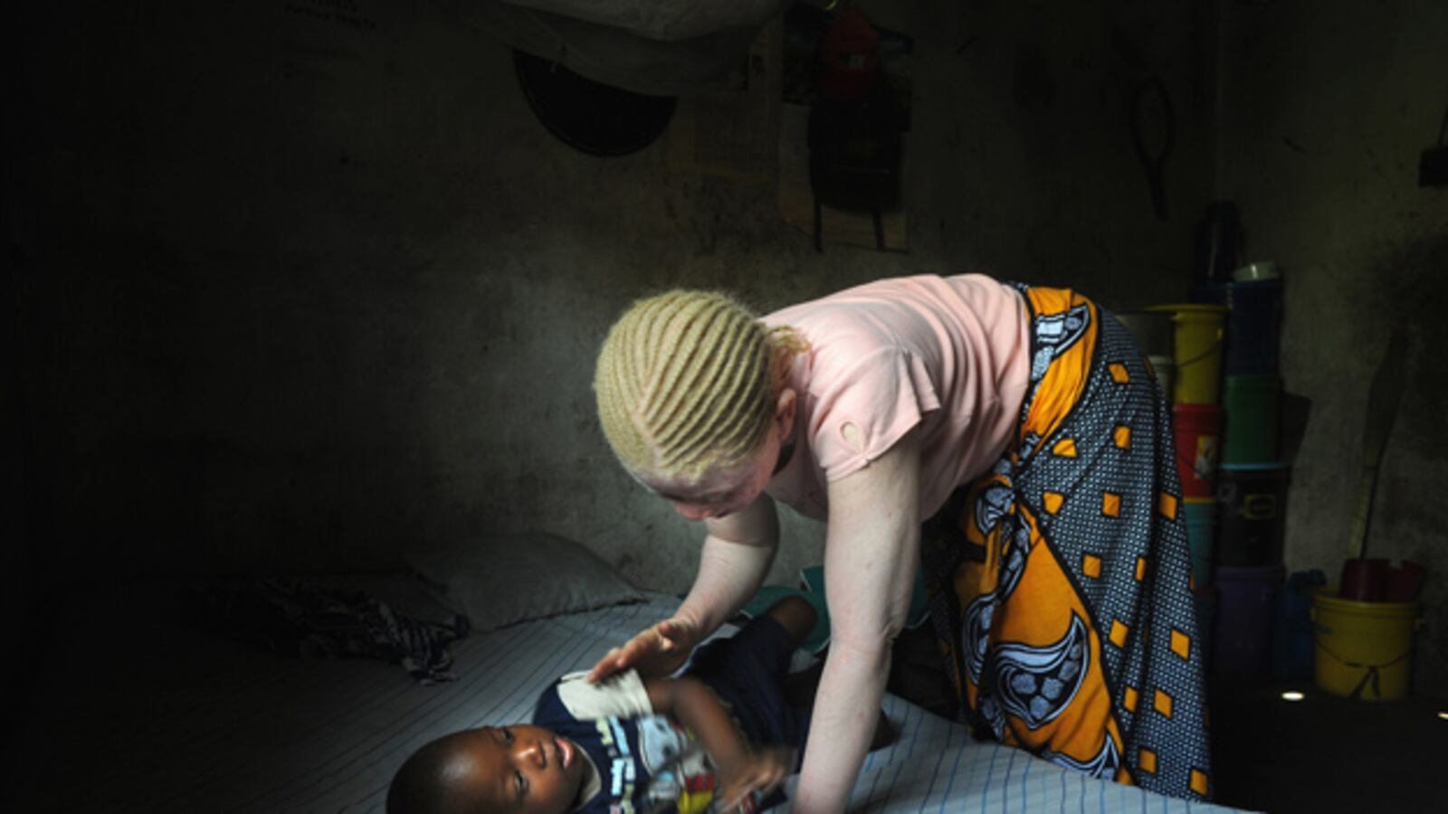 galleries/2009/10/26/a-gruesome-black-market-in-albino-limbs/tanzania-albinos---1_qqo67b