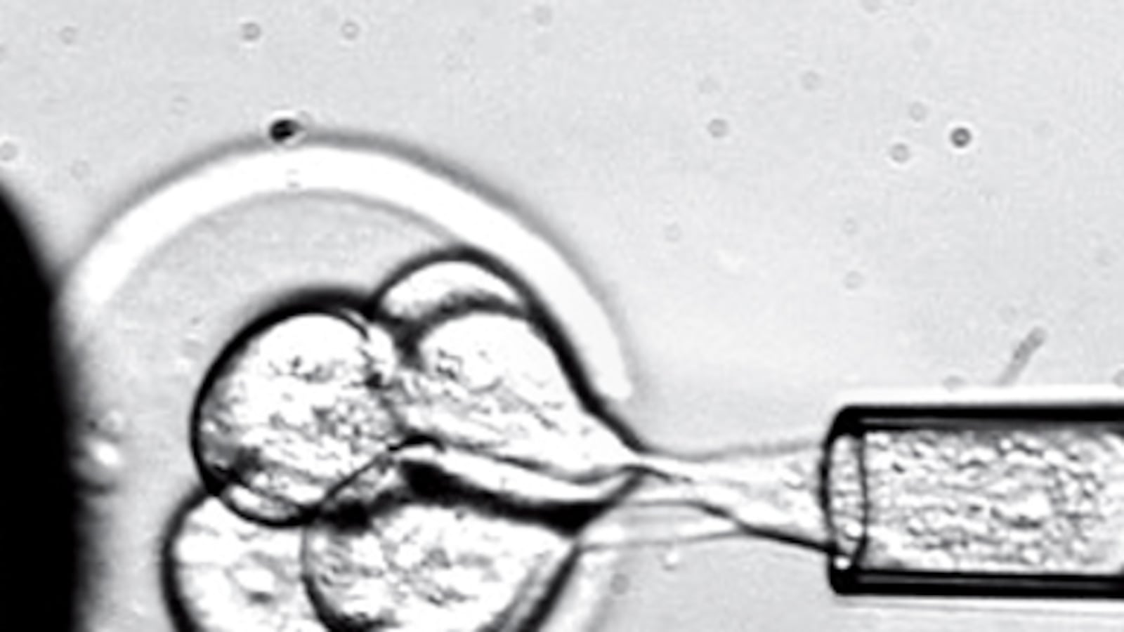 articles/2011/05/16/embryonic-stem-cell-therapy-are-we-on-the-brink-of-results/begley-stem-cells_180575_zoqtx3