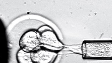 articles/2011/05/16/embryonic-stem-cell-therapy-are-we-on-the-brink-of-results/begley-stem-cells_180575_zoqtx3