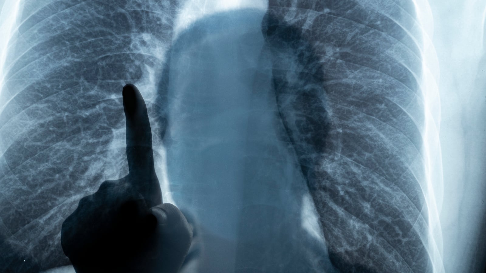 GettyImages-1297238827_qnk9d1