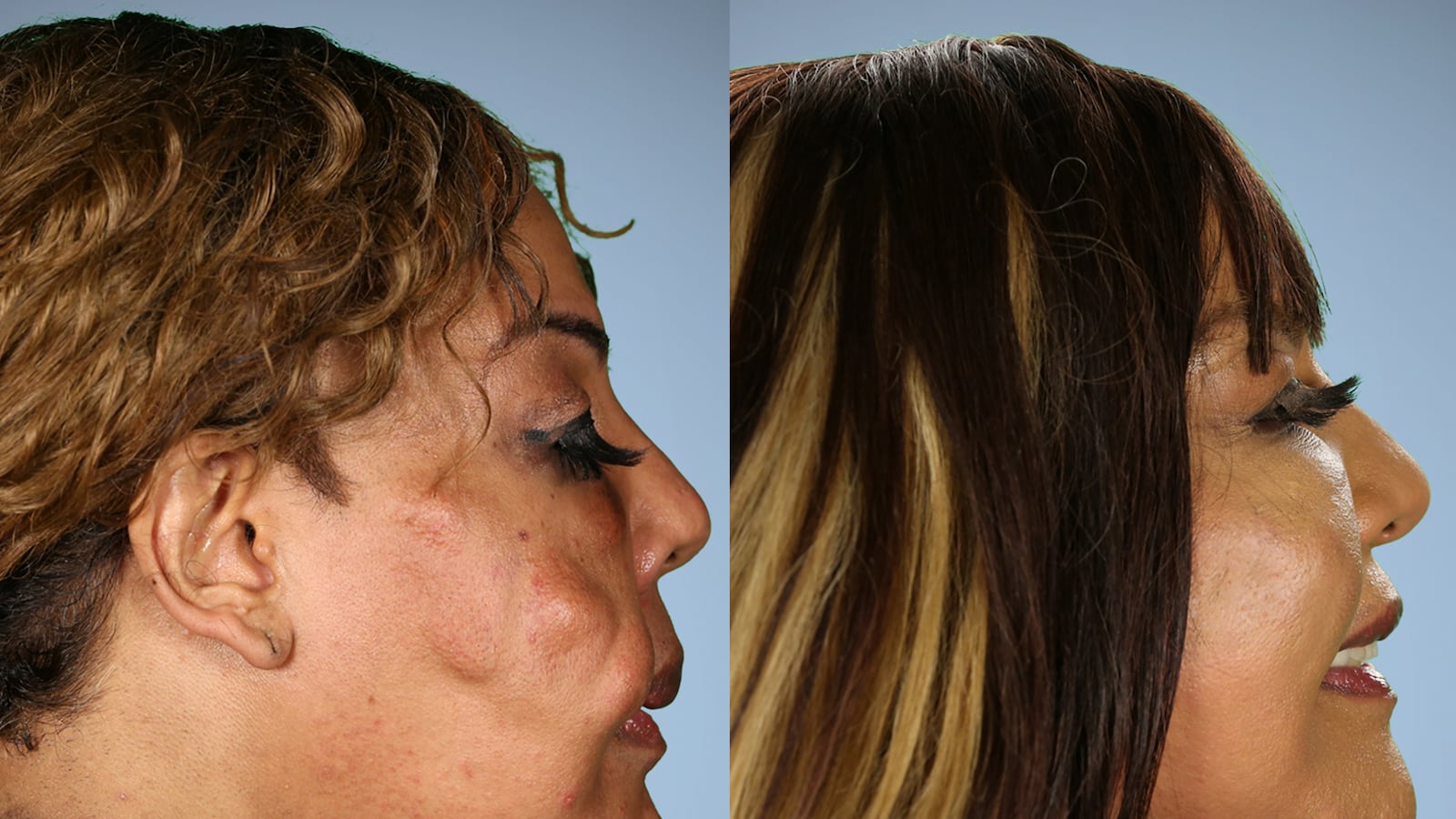 articles/2016/05/14/the-botched-docs-explain-why-plastic-surgery-is-hotter-and-scarier-than-ever/160512-fallon-botched-tease_xuwgrq