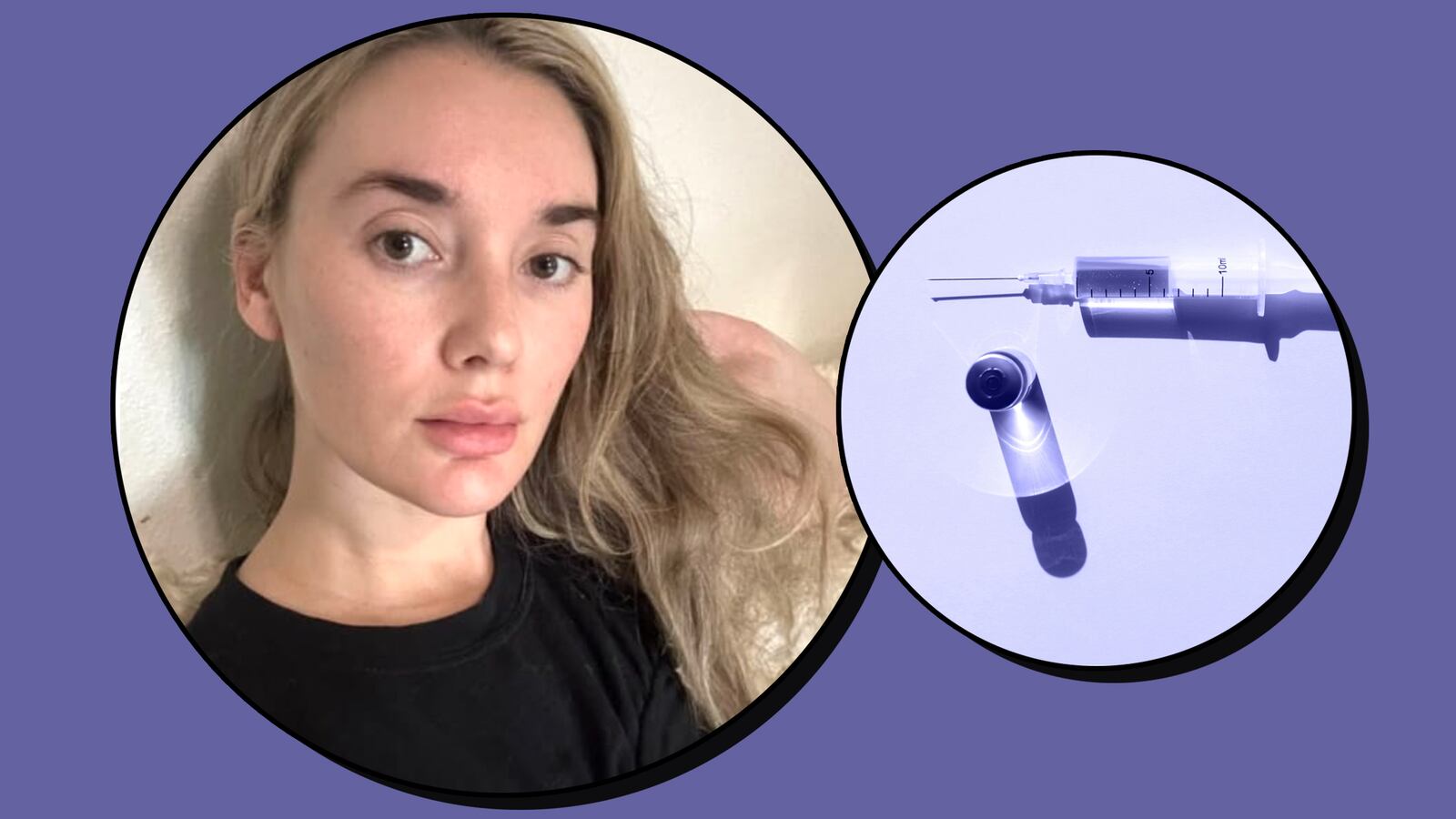 Nefertiti Lift Botox Before and After Review | Scouted, The Daily Beast