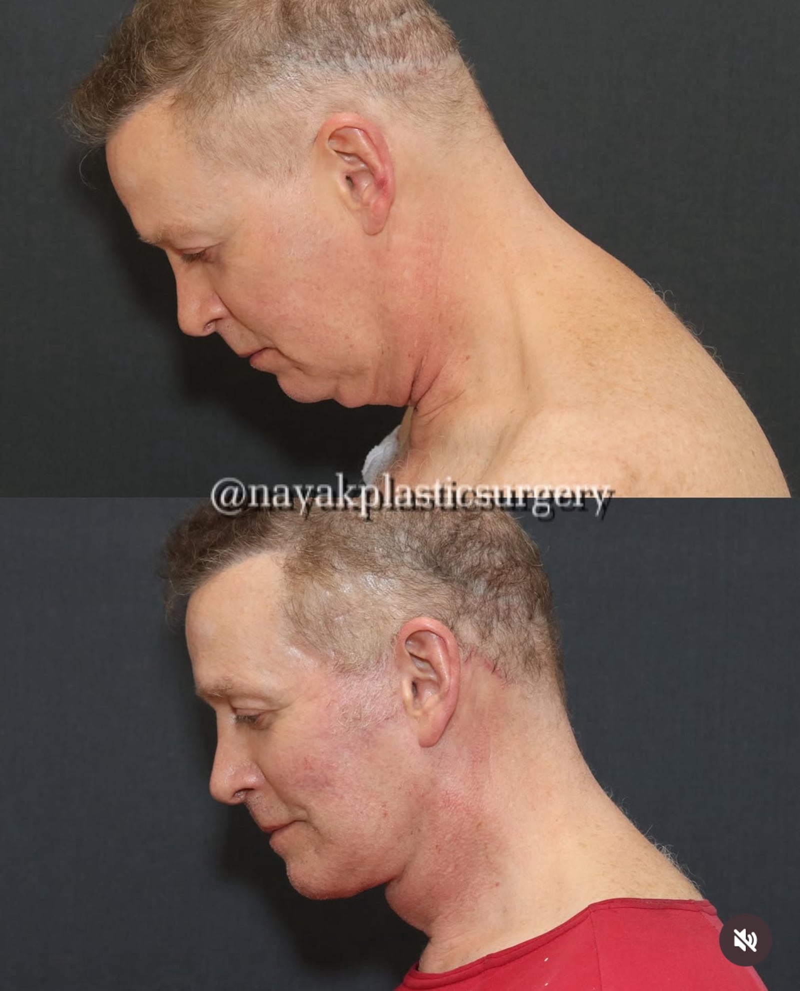 Before-and-after photos of John Spaedy.