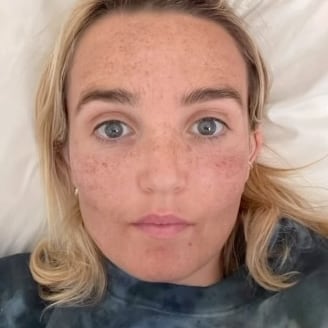 'Saturday Night Live' star Chloe Fineman posts photos from her 'Botched' album of her selfies after skincare treatments.