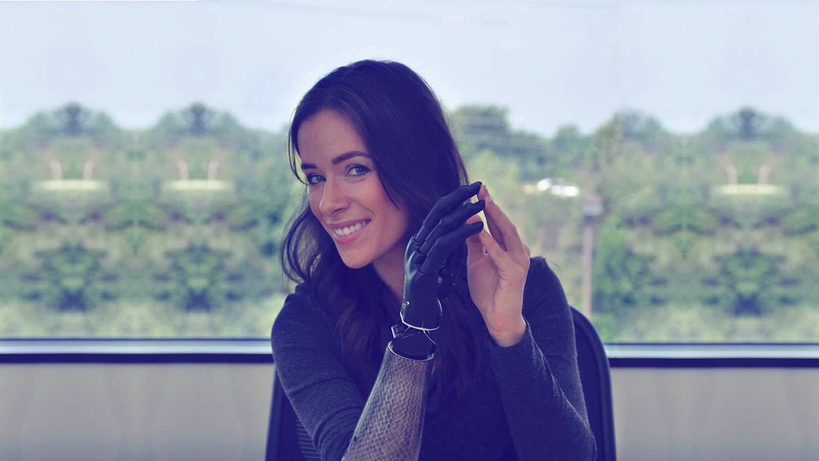 articles/2015/09/12/meet-the-model-with-the-bionic-arm/150911-shire-marine-tease_mlhdyq