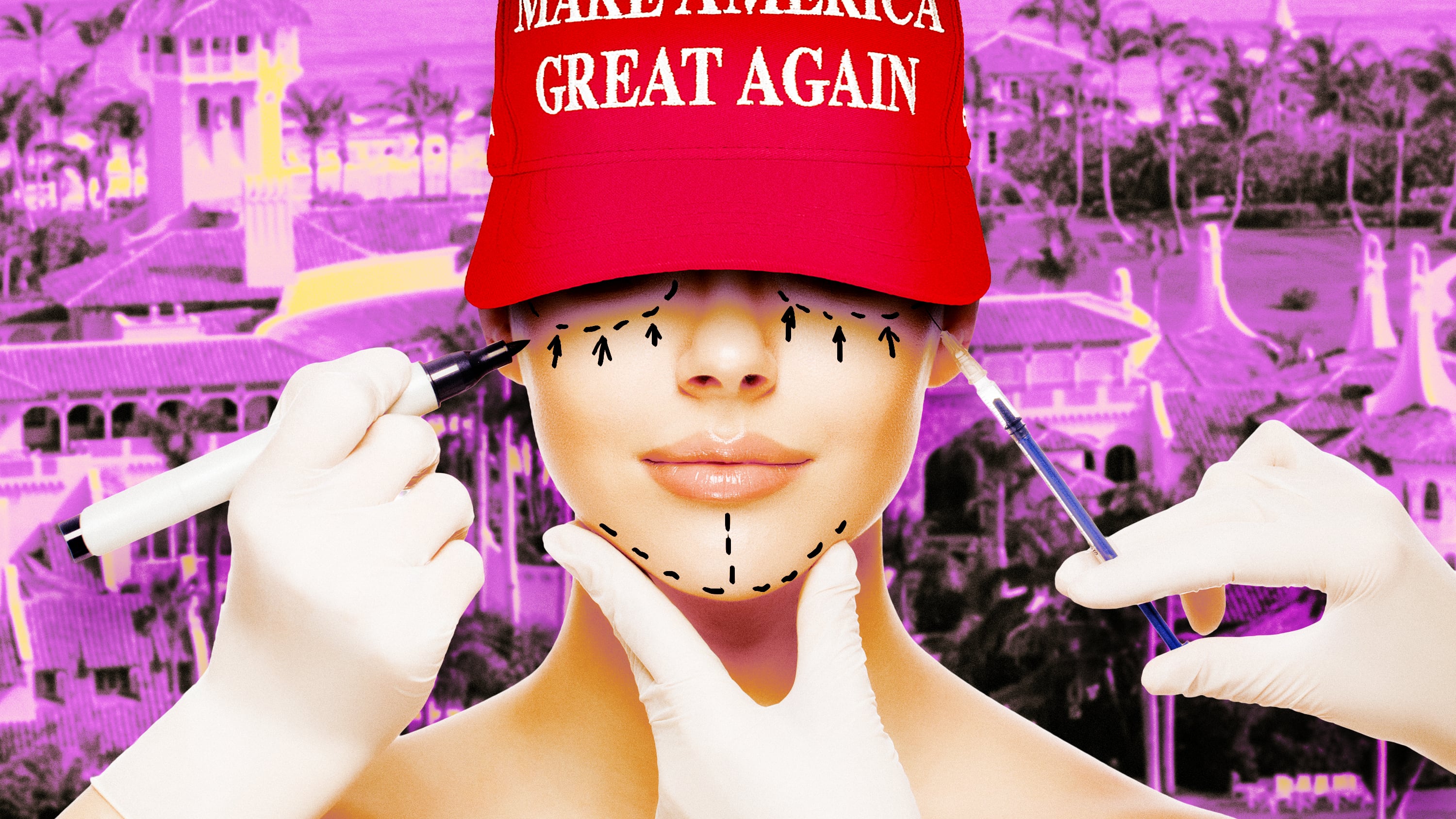 A photo illustration of a woman wearing a MAGA hat getting plastic surgery marks in front of Mar-A-Lago.