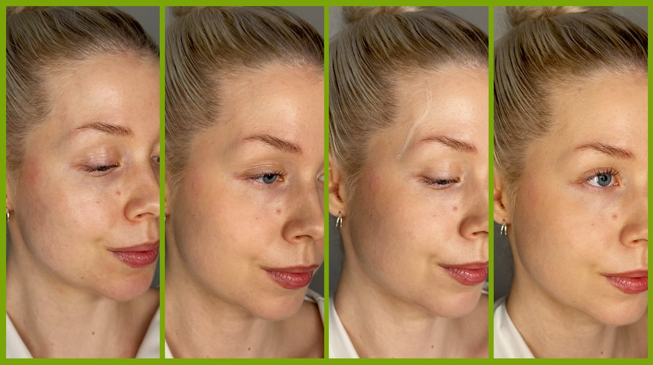 Before and After of Roosa Rahkonen using makeup to conceal veins.