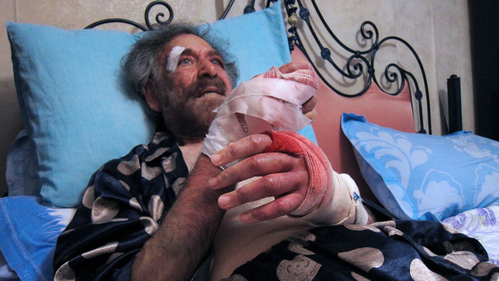 cheats/2011/08/25/syrian-political-cartoonist-beaten/ali-farzat-syria-beaten-cheat_j3qhk5