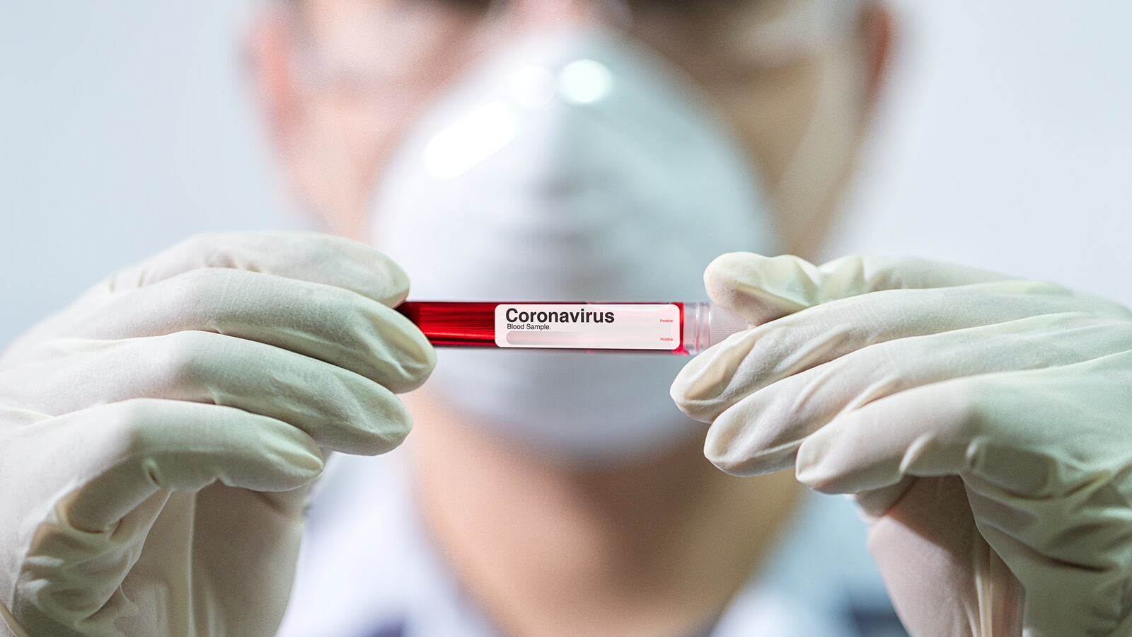 20902-khn-plasma-tease_md5xj9