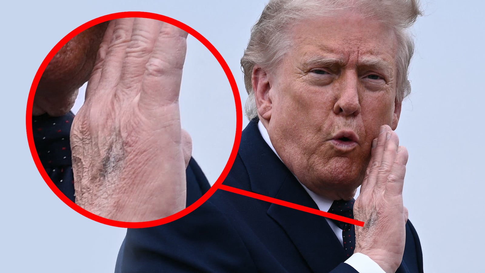 A close-up of Trump's discolored hand.
