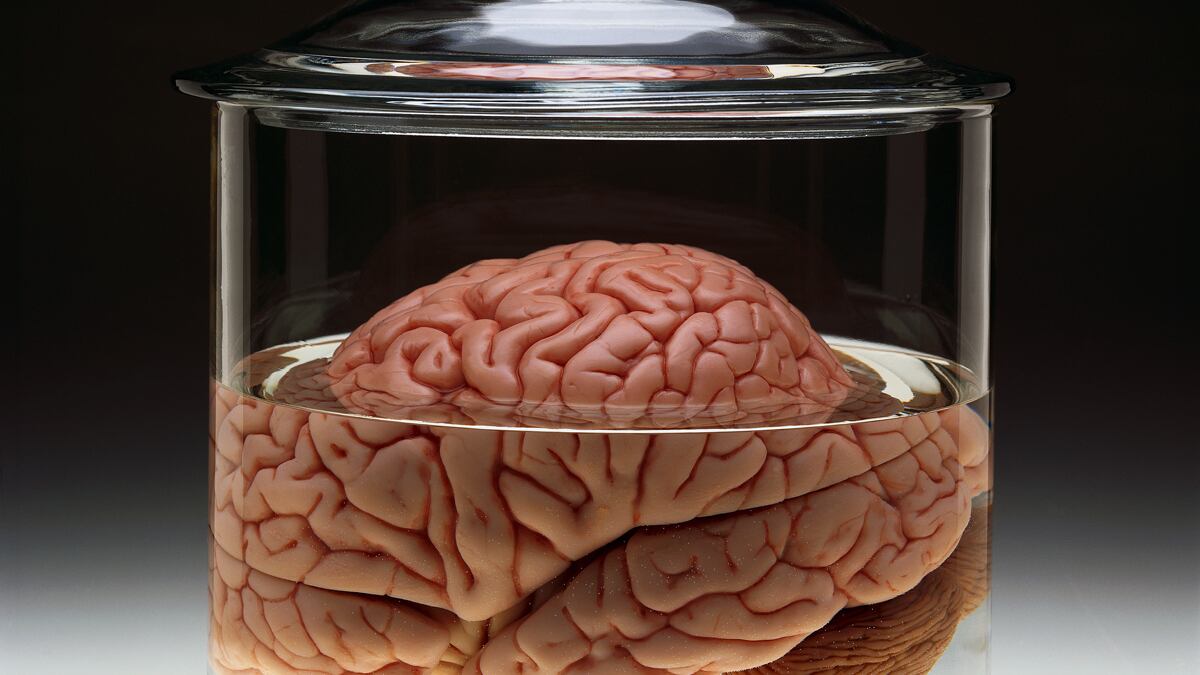 cheats/2012/10/28/nyc-stockpile-of-brains-questioned/brain-specimen-new-york-cheat_tcslz2